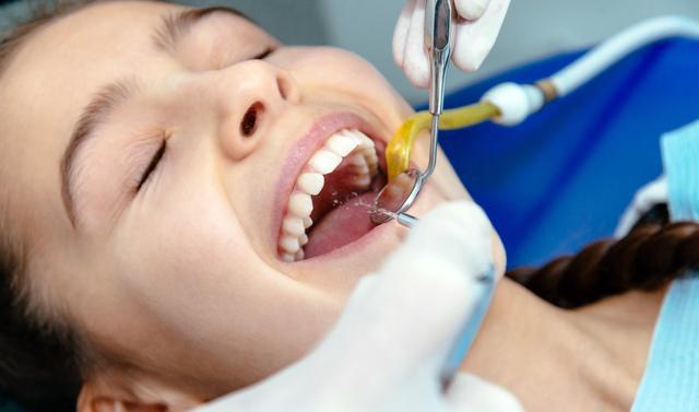 关于洗牙的4个谣言，牙医都辟谣了，还有人深信不疑