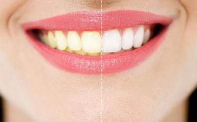 牙齿变黄的五大原因