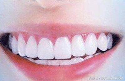 让你的牙齿美白除了整形，其实还可以这样！