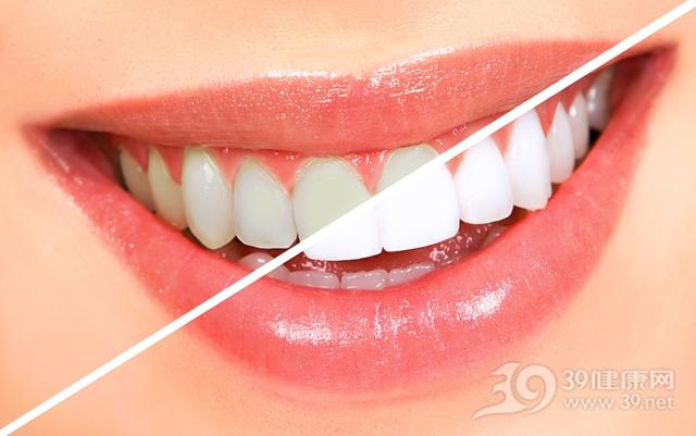 牙齿越白越好？错了！牙齿整形的3大误区，你中了多少个？