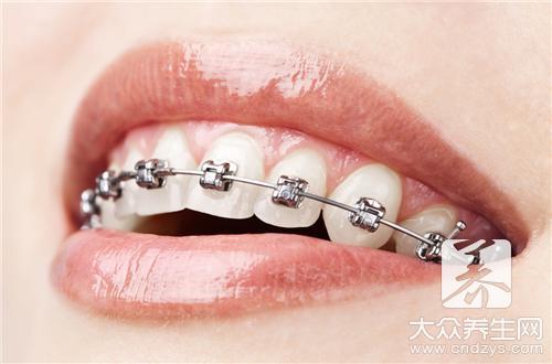 矫正牙齿的这些严重危害你知不知道呢？