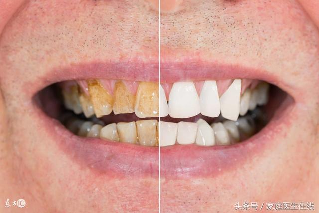 牙科医生：奉上三个美白牙齿小窍门，可别错过了！