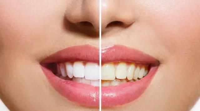 洗牙、用盐擦，这些方法哪个能美白牙齿？