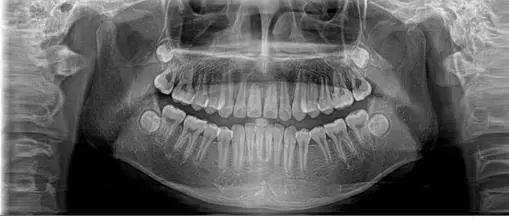 牙齿矫正咨询的正确姿势收集
