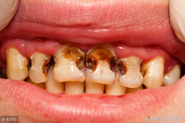 牙黄牙黑，冷光美白牙齿靠谱吗？能保持多久？