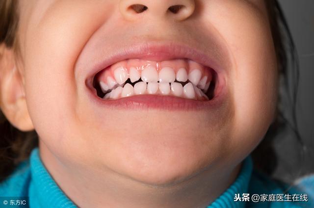 儿童牙齿畸形有哪些情况？做到这3点能预防牙齿畸形
