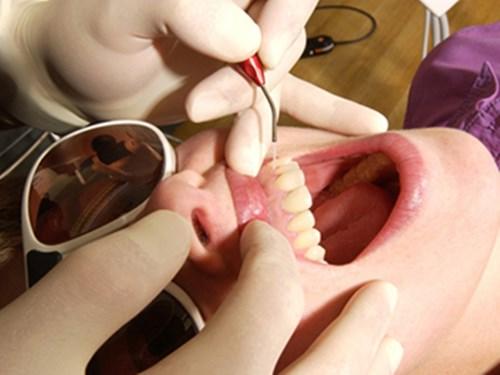 大连齿医生口腔科普 错颌畸形牙的矫正方式有哪些